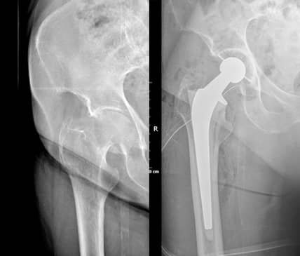 Slider image (6) Dr. Metztli Linette Gomez Espinoza - Orthopedic Clinic